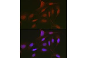 Immunofluorescence analysis of U2OS cells using RBL2 Rabbit pAb (ABIN7269943) at dilution of 1:50 (40x lens). (p130 anticorps  (AA 100-200))
