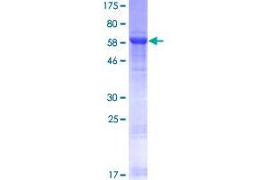 Image no. 1 for Nuclear Transcription Factor Y, gamma (NFYC) (AA 1-335) protein (GST tag) (ABIN1312521)