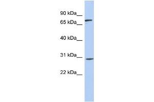 WB Suggested Anti-ZNF131 Antibody Titration:  0. (ZNF131 anticorps  (Middle Region))