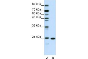 Western Blotting (WB) image for anti-Ribosomal Protein L9 (RPL9) antibody (ABIN2462050) (RPL9 anticorps)