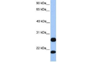 WB Suggested Anti-C1orf63 Antibody Titration:  0. (C1orf63 anticorps  (C-Term))