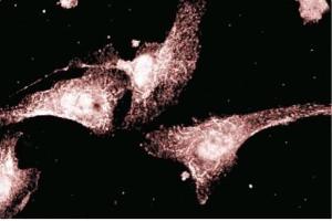 Immunofluorescent staining of endothelial cells.