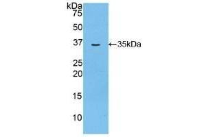 Detection of Recombinant MYO1D, Rat using Polyclonal Antibody to Myosin ID (MYO1D) (Myosin ID anticorps  (AA 512-788))