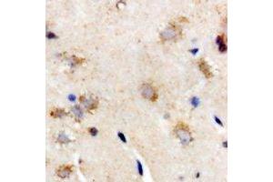 Immunohistochemical analysis of Interferon lambda-3 staining in rat brain formalin fixed paraffin embedded tissue section. (IL28B anticorps)