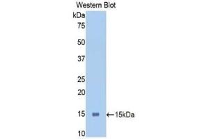 Detection of Recombinant PIGR, Mouse using Polyclonal Antibody to Polymeric Immunoglobulin Receptor (PIGR)