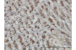 Immunoperoxidase of monoclonal antibody to GMPPB on formalin-fixed paraffin-embedded human adrenal gland.
