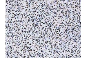 IHC analysis of AREB6/ZEB1 using anti-AREB6/ZEB1 antibody (ABIN7602990).