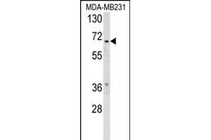 Western blot analysis of RXRB Antibody (Center) (ABIN653727 and ABIN2843034) in MDA-M cell line lysates (35 μg/lane). (Retinoid X Receptor beta anticorps  (AA 256-284))