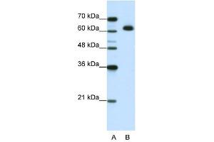 MGC42174 antibody used at 1. (DIS3L2 anticorps  (N-Term))