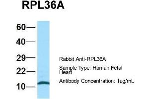 Host: Rabbit  Target Name: RPL36A  Sample Tissue: Human Fetal Heart  Antibody Dilution: 1.