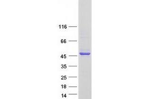 Validation with Western Blot