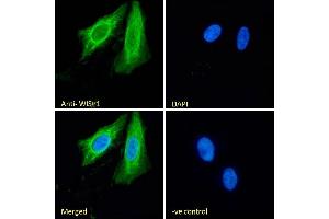 (ABIN238610) Immunofluorescence analysis of paraformaldehyde fixed U2OS cells, permeabilized with 0.