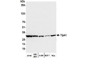 Western Blotting (WB) image for anti-TIP41-like protein (TIPRL) (C-Term) antibody (ABIN7453900) (TIPRL anticorps  (C-Term))
