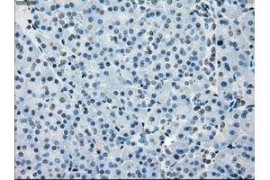 Immunohistochemistry (IHC) image for anti-Budding Uninhibited By Benzimidazoles 1 Homolog beta (Yeast) (BUB1B) antibody (ABIN1496995) (BUB1B anticorps)
