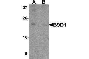 Western blot analysis of B9D1 in 293 cell lysate with B9D1 antibody at 1 µg/mL in (A) the absence and (B) the presence of blocking peptide. (B9D1 anticorps  (C-Term))