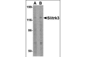 Western blot analysis of Slitrk3 in SK-N-SH cell lysate with this product at (A) 0. (SLITRK3 anticorps  (C-Term))