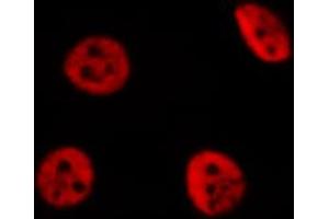 ABIN6274259 staining Hela cells by IF/ICC. (YAP1 anticorps  (Internal Region))
