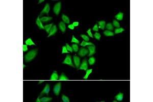 Immunofluorescence analysis of A549 cells using GALE Polyclonal Antibody (GALE anticorps)