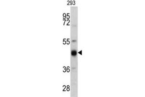 Western Blotting (WB) image for anti-Keratin 13 (KRT13) antibody (ABIN3002761)