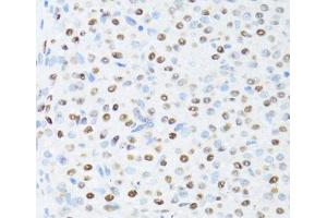 Immunohistochemistry of paraffin-embedded Rat ovary using DDX39B Polyclonal Antibody at dilution of 1:100 (40x lens).