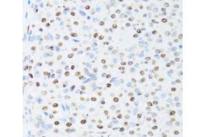 Immunohistochemistry of paraffin-embedded Rat ovary using DDX39B Polyclonal Antibody at dilution of 1:100 (40x lens). (DDX39B anticorps)