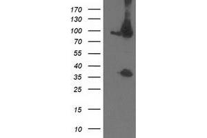 Western Blotting (WB) image for anti-Proteasome (Prosome, Macropain) 26S Subunit, Non-ATPase, 2 (PSMD2) antibody (ABIN1500480) (PSMD2 anticorps)