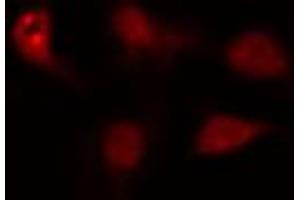 ABIN6274432 staining HeLa cells by IF/ICC. (ZNF397 anticorps  (N-Term))