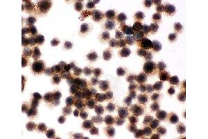 ICC testing of Jurkat cells