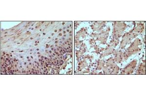 Immunohistochemical staining of paraffin-embedded human normal esophagus (A) and stomach (B) tissue, showing nucleus localization using Rb mouse mAb with DAB staining. (Retinoblastoma 1 anticorps)
