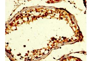 IHC image of ABIN7154533 diluted at 1:200 and staining in paraffin-embedded human testis tissue performed on a Leica BondTM system. (GDF1 anticorps  (AA 369-478))