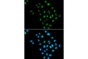 Immunofluorescence analysis of MCF7 cell using EIF6 antibody. (EIF6 anticorps)