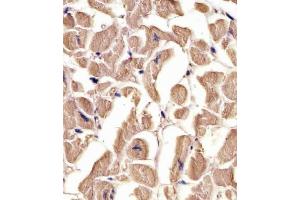 (ABIN655982 and ABIN2845366) staining TUBA1C in human heart tissue sections by Immunohistochemistry (IHC-P - paraformaldehyde-fixed, paraffin-embedded sections). (TUBA1C anticorps  (C-Term))