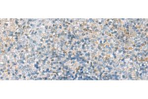 Immunohistochemistry of paraffin-embedded Human tonsil tissue using EMILIN1 Polyclonal Antibody at dilution of 1:70(x200) (Emilin1 anticorps)