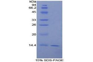 SDS-PAGE (SDS) image for Urocortin 2 (UCN2) (AA 20-112) protein (His tag) (ABIN1081101)