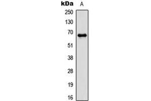 Western blot analysis of PAK1 (pT212) expression in HCT116 (A) whole cell lysates. (PAK1 anticorps  (pSer212))