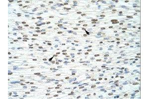 Image no. 1 for anti-HKR1, GLI-Kruppel Zinc Finger Family Member (HKR1) (C-Term) antibody (ABIN6736165)