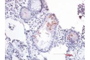 Immunohistochemistry image of B-Defensin 2 staining in paraffn section of human colon resection tissue. (beta 2 Defensin anticorps  (AA 4-41))
