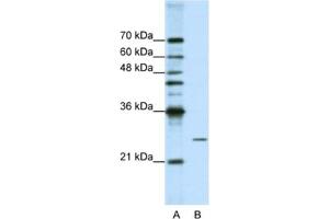 Western Blotting (WB) image for anti-Processing of Precursor 4, Ribonuclease P/MRP Subunit (POP4) antibody (ABIN2462223) (RPP29 anticorps)