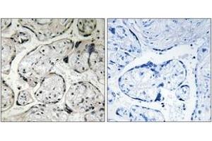 Immunohistochemistry analysis of paraffin-embedded human placenta tissue, using CYB5R3 Antibody.