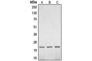 Western blot analysis of Caspase 2 p18 expression in mouse brain (A), rat brain (B), PC12 UV-treated (C) whole cell lysates. (Caspase 2 p18 anticorps  (Center))