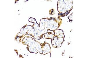 Immunohistochemistry of paraffin-embedded human placenta using HSD17B1 antibody (ABIN6129829, ABIN6142002, ABIN6142003 and ABIN6215013) at dilution of 1:100 (40x lens). (HSD17B1 anticorps  (AA 1-328))