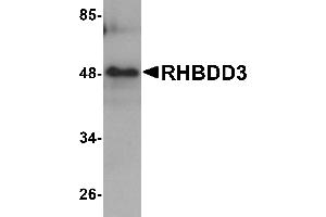 Western blot analysis of RHBDD3 in rat lung tissue lysate with RHBDD3 antibody at 1 µg/mL.