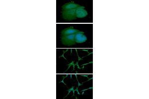 ICC/IF analysis of ARF1 in MCF7 cell line, stained with DAPI (Blue) for nucleus staining and monoclonal anti-human ARF1 antibody (1:100) with goat anti-mouse IgG-Alexa fluor 488 conjugate (Green). (ARF1 anticorps)