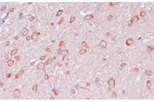 Immunohistochemistry of paraffin-embedded Rat brain using RPL32 Polyclonal Antibody at dilution of 1:100 (40x lens). (RPL32 anticorps)