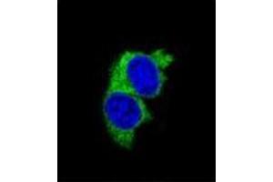 Confocal immunofluorescent analysis of MMP1 Antibody (Center) Cat.