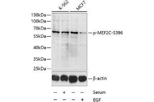 Western blot analysis of extracts of K-562 and MCF-7 cells using Phospho-MEF2C(S396) Polyclonal Antibody at dilution of 1:1000. (MEF2C anticorps  (pSer396))