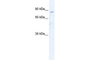 WB Suggested Anti-SIRT1 Antibody Titration:  0. (SIRT1 anticorps  (N-Term))