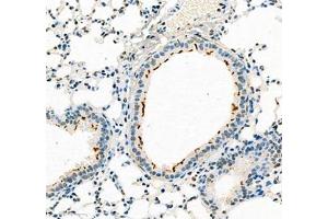 Immunohistochemistry of paraffin embedded mouse pneumonia using B3GALT4 (ABIN7073157) at dilution of 1:400 (300x lens)
