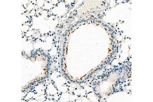 Immunohistochemistry of paraffin embedded mouse pneumonia using B3GALT4 (ABIN7073157) at dilution of 1:400 (300x lens) (ATP6V1C2 anticorps)