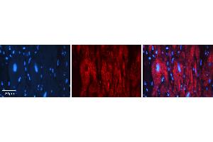 Rabbit Anti-PEA15 Antibody   Formalin Fixed Paraffin Embedded Tissue: Human heart Tissue Observed Staining: Cytoplasmic Primary Antibody Concentration: 1:100 Other Working Concentrations: N/A Secondary Antibody: Donkey anti-Rabbit-Cy3 Secondary Antibody Concentration: 1:200 Magnification: 20X Exposure Time: 0.